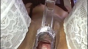 Polys gaping pussy speculum show
